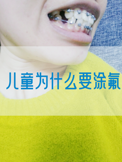 儿童为什么要涂氟