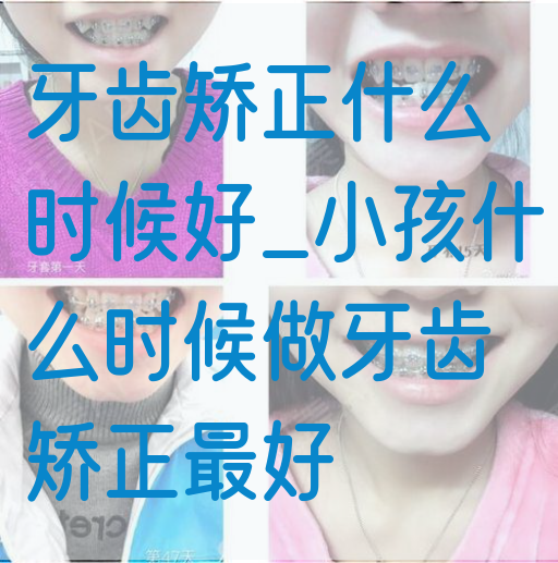 牙齿矫正什么时候好_小孩什么时候做牙齿矫正最好(图1)