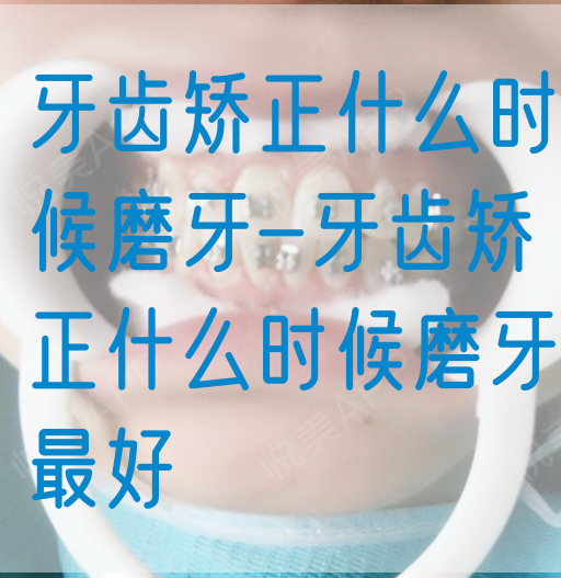 牙齿矫正什么时候磨牙-牙齿矫正什么时候磨牙最好(图1)