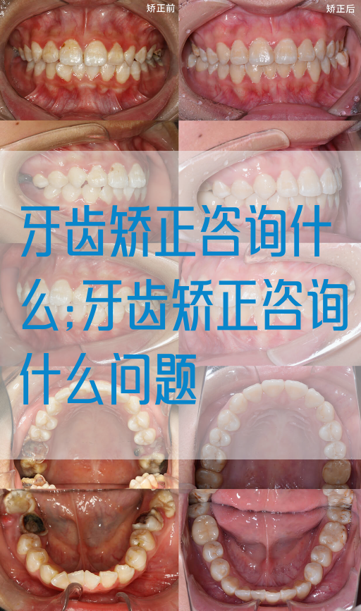 牙齿矫正咨询什么;牙齿矫正咨询什么问题