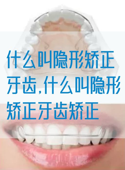 什么叫隐形矫正牙齿,什么叫隐形矫正牙齿矫正