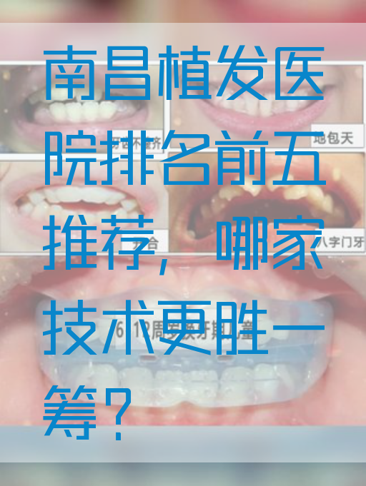 南昌植发医院排名前五推荐，哪家技术更胜一筹？