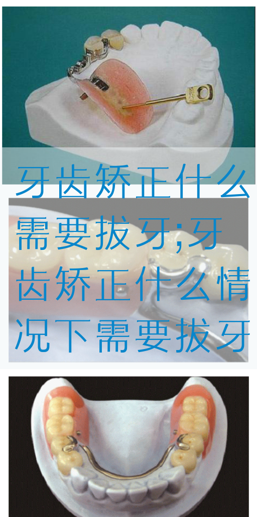 牙齿矫正什么需要拔牙;牙齿矫正什么情况下需要拔牙