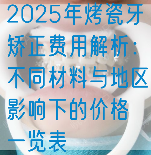 2025年烤瓷牙矫正费用解析：不同材料与地区影响下的价格一览表