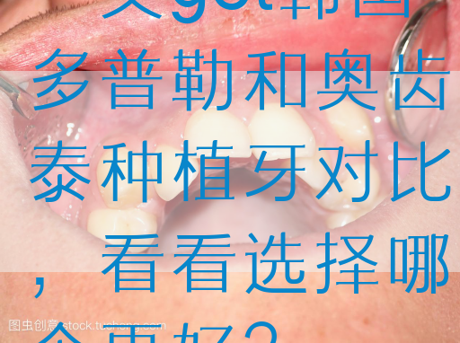一文get韩国多普勒和奥齿泰种植牙对比，看看选择哪个更好？