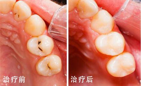 济南联合博士口腔怎么样？正规靠谱，让您明明白白消费(图1)
