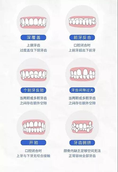 义获嘉全瓷贴面和白牙吖全瓷贴面价格对比：哪种更*济实惠？价目表一览(图1)
