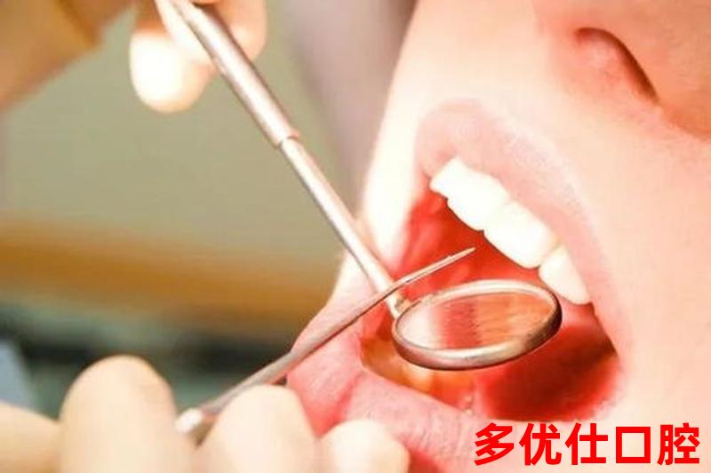 网上卖超声波洗牙器行吗、自己买超声波洗牙器对牙齿有害吗：*超声波洗牙器，让口腔健康更简单
