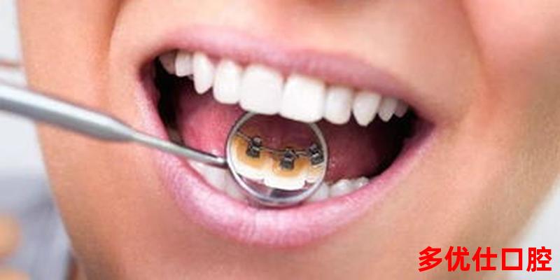 带硅胶牙套牙齿会松动吗—带硅胶牙套的好处和坏处