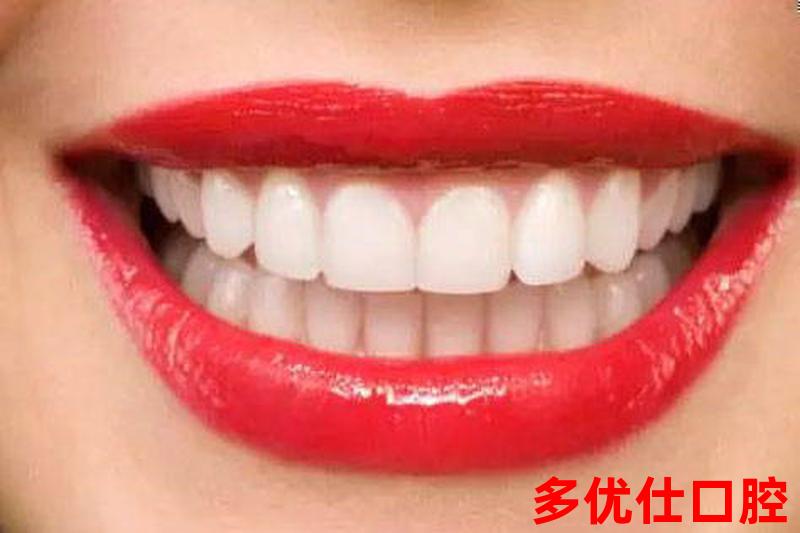牙齿发出口臭为什么要拔牙—因为牙齿导致口臭