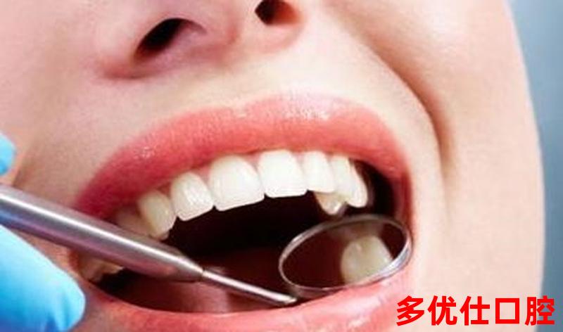 牙齿发黄口臭怎么去除牙垢—牙齿变黄口臭怎么回事