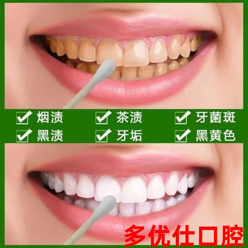 牙齿变白怎么清除口臭;牙齿白怎么办