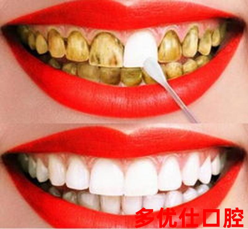 牙齿发黄有口臭怎么治好_牙齿发黄有口臭怎么治好得快