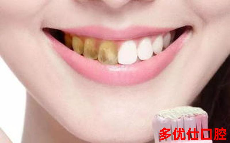 牙齿有烟渍会口臭吗吗_牙齿有烟迹