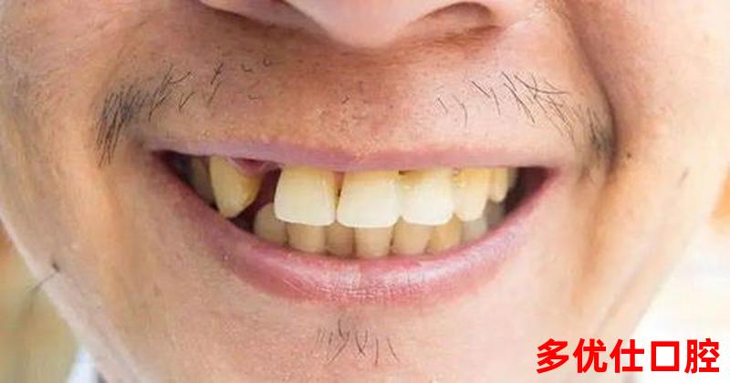 牙齿烂了为什么不会口臭,烂掉的牙齿为什么这么臭