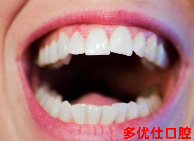 牙齿矫正结束后口臭正常吗-牙齿矫正后口腔出现异味是怎么回事