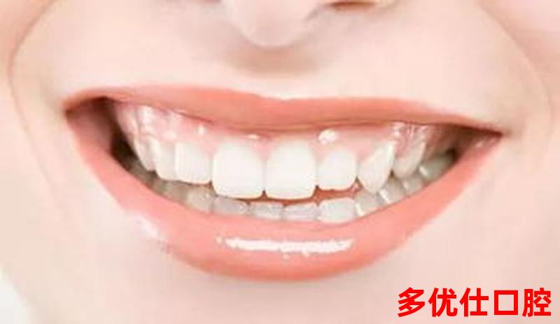 矫正牙齿牙龈不出血怎么办_牙齿矫正牙龈出血是什么原因