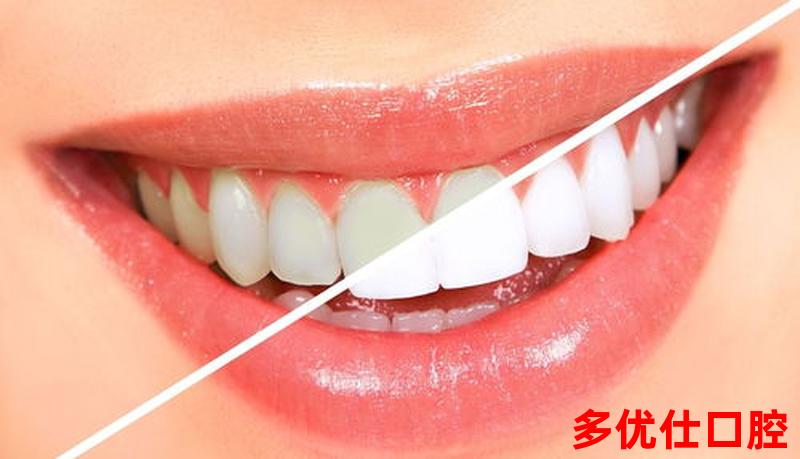 补过牙齿牙龈出血怎么回事、补过的牙牙龈出血怎么回事