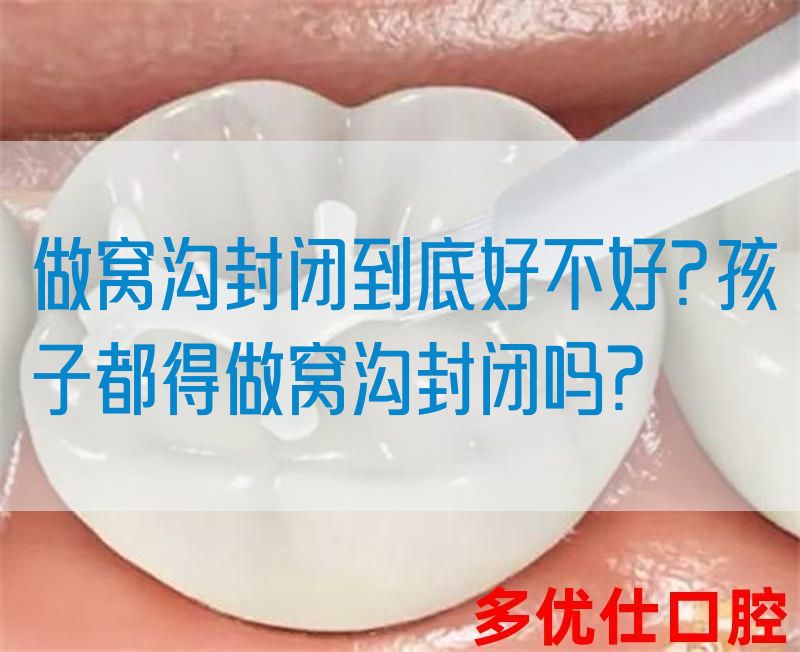做窝沟封闭到底好不好?孩子都得做窝沟封闭吗?(图1)