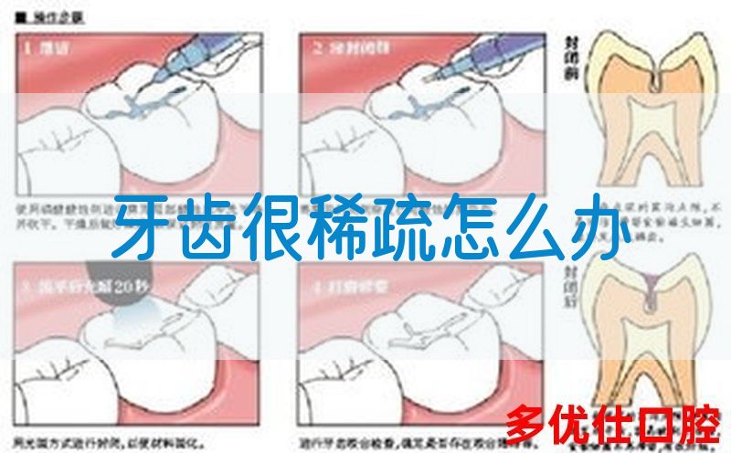 牙齿很稀疏怎么办(图1)