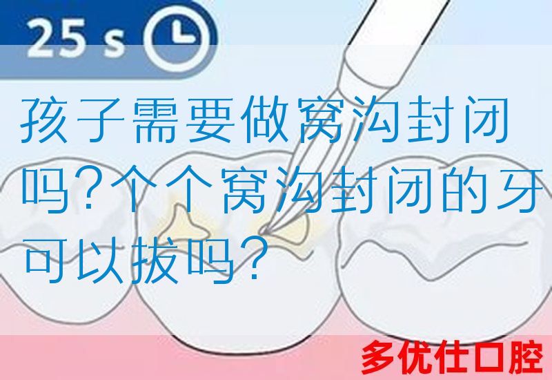 孩子需要做窝沟封闭吗?个个窝沟封闭的牙可以拔吗?(图1)