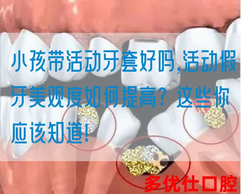 小孩带活动牙套好吗,活动假牙美观度如何提高?这些你应该知道！(图1)