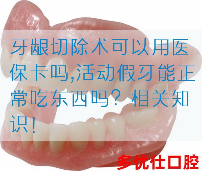 牙龈切除术可以用医|保卡吗,活动假牙能正常吃东西吗？相关知识！(图1)