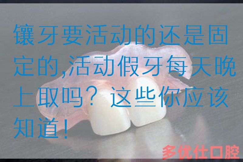 镶牙要活动的还是固定的,活动假牙每天晚上取吗？这些你应该知道！(图1)