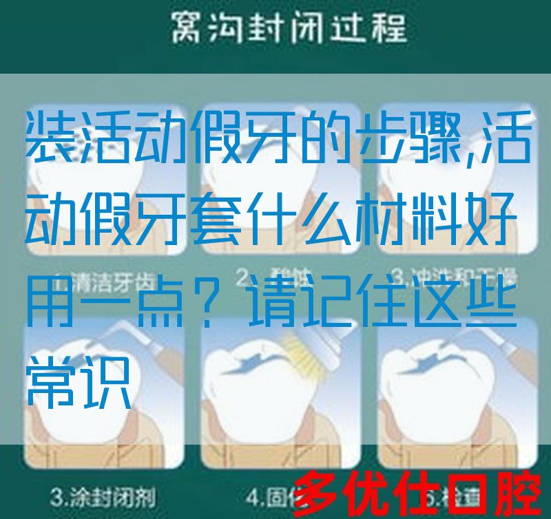 装活动假牙的步骤,活动假牙套什么材料好用一点？请记住这些常识(图1)