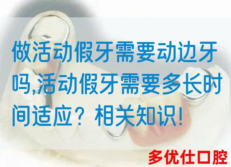 做活动假牙需要动边牙吗,活动假牙需要多长时间适应？相关知识！(图1)