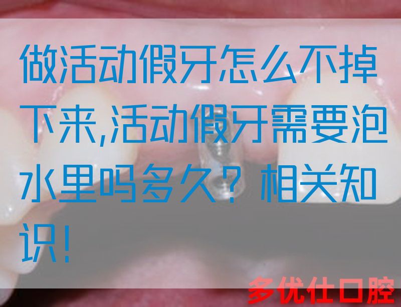 做活动假牙怎么不掉下来,活动假牙需要泡水里吗多久？相关知识！(图1)
