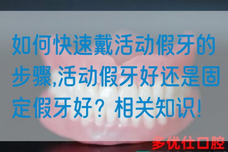 如何快速戴活动假牙的步骤,活动假牙好还是固定假牙好？相关知识！(图1)