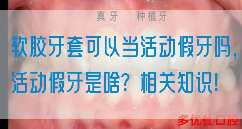 软胶牙套可以当活动假牙吗,活动假牙是啥？相关知识！(图1)