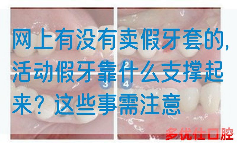 网上有没有卖假牙套的,活动假牙靠什么支撑起来？这些事需注意(图1)