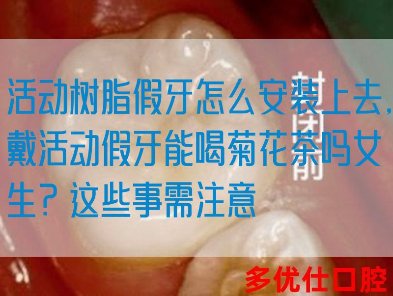 活动树脂假牙怎么安装上去,戴活动假牙能喝菊花茶吗女生？这些事需注意(图1)