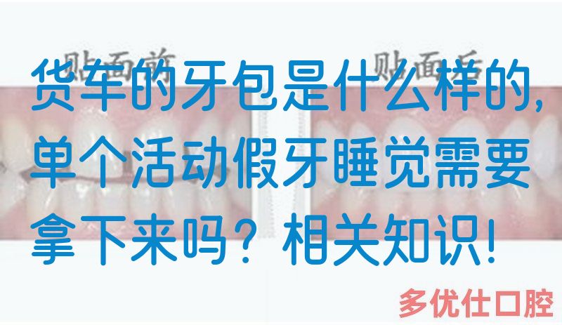货车的牙包是什么样的,单个活动假牙*觉需要拿下来吗？相关知识！(图1)