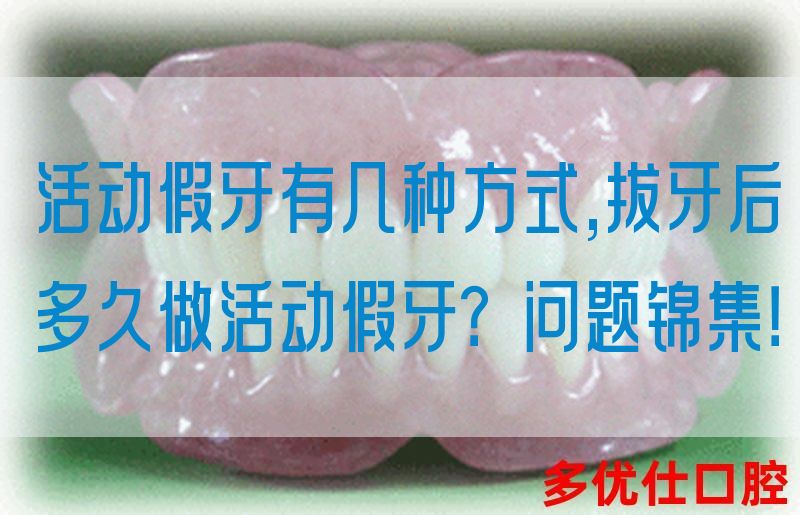 活动假牙有几种方式,拔牙后多久做活动假牙？问题锦集！(图1)