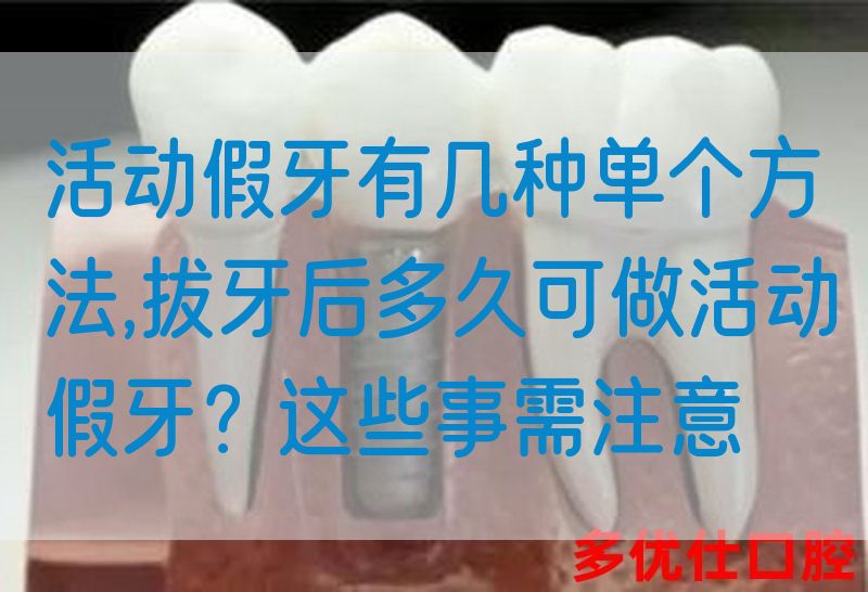 活动假牙有几种单个方法,拔牙后多久可做活动假牙？这些事需注意(图1)