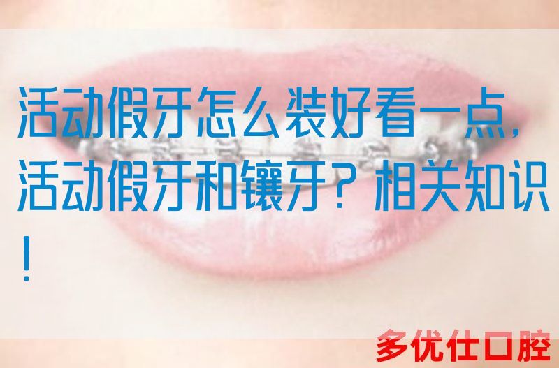 活动假牙怎么装好看一点,活动假牙和镶牙？相关知识！(图1)