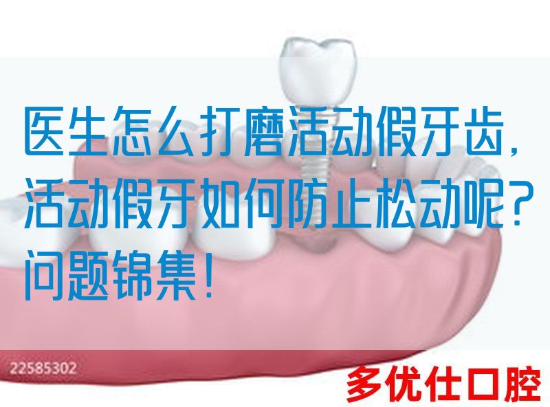 医生怎么打磨活动假牙齿,活动假牙如何防止松动呢？问题锦集！