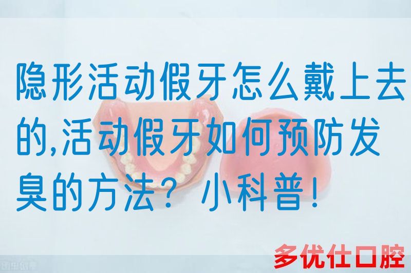 隐形活动假牙怎么戴上去的,活动假牙如何预防发臭的方法？小科普！(图1)