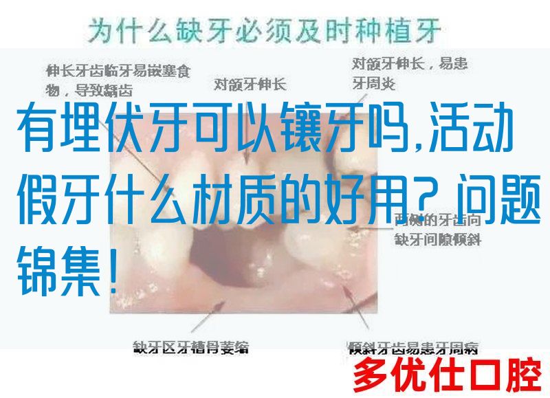 有埋伏牙可以镶牙吗,活动假牙什么材质的好用？问题锦集！(图1)