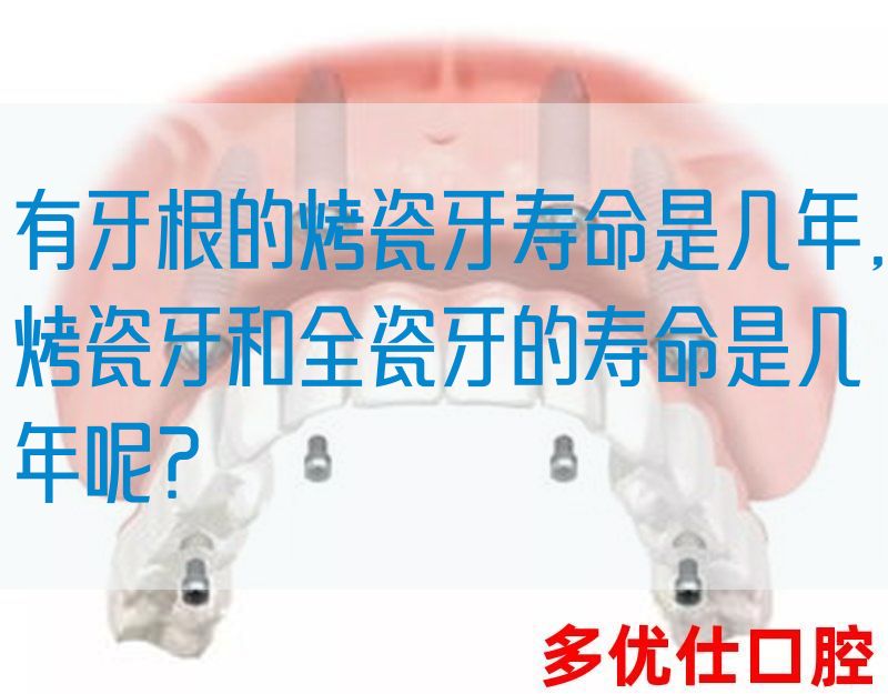 有牙根的烤瓷牙寿命是几年,烤瓷牙和全瓷牙的寿命是几年呢？(图1)