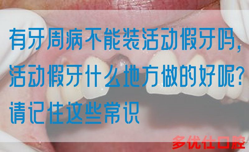 有牙周病不能装活动假牙吗,活动假牙什么地方做的好呢？请记住这些常识(图1)