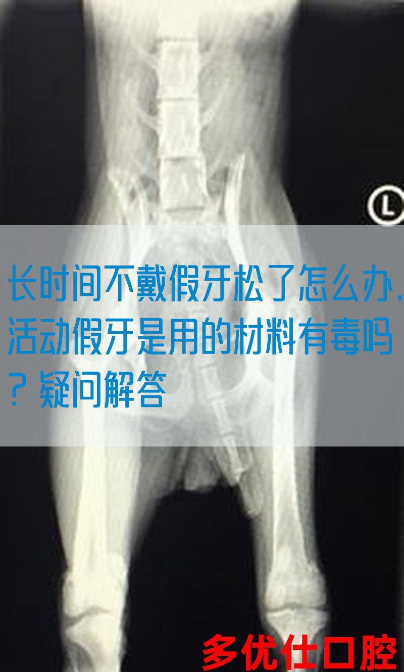 长时间不戴假牙松了怎么办,活动假牙是用的材料有毒吗？疑问解答(图1)