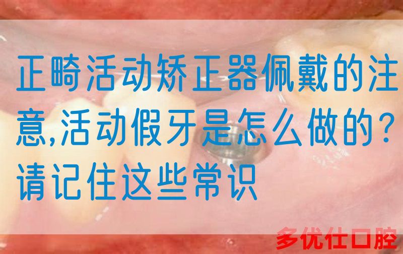 正畸活动矫正器佩戴的注意,活动假牙是怎么做的？请记住这些常识(图1)