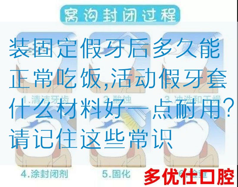 装固定假牙后多久能正常吃饭,活动假牙套什么材料好一点耐用？请记住这些常识(图1)