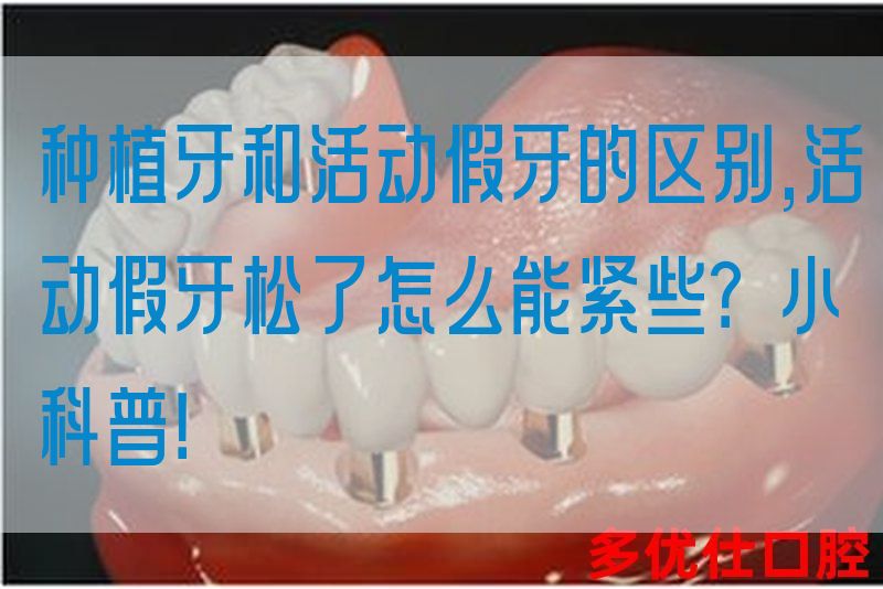 种植牙和活动假牙的区别,活动假牙松了怎么能紧些？小科普！(图1)