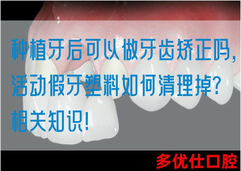 种植牙后可以做牙齿矫正吗,活动假牙塑料如何清理掉？相关知识！(图1)