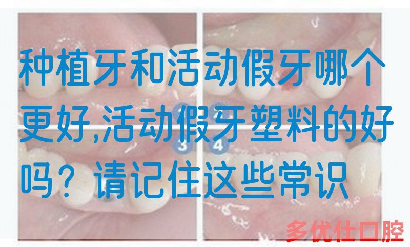 种植牙和活动假牙哪个更好,活动假牙塑料的好吗？请记住这些常识(图1)